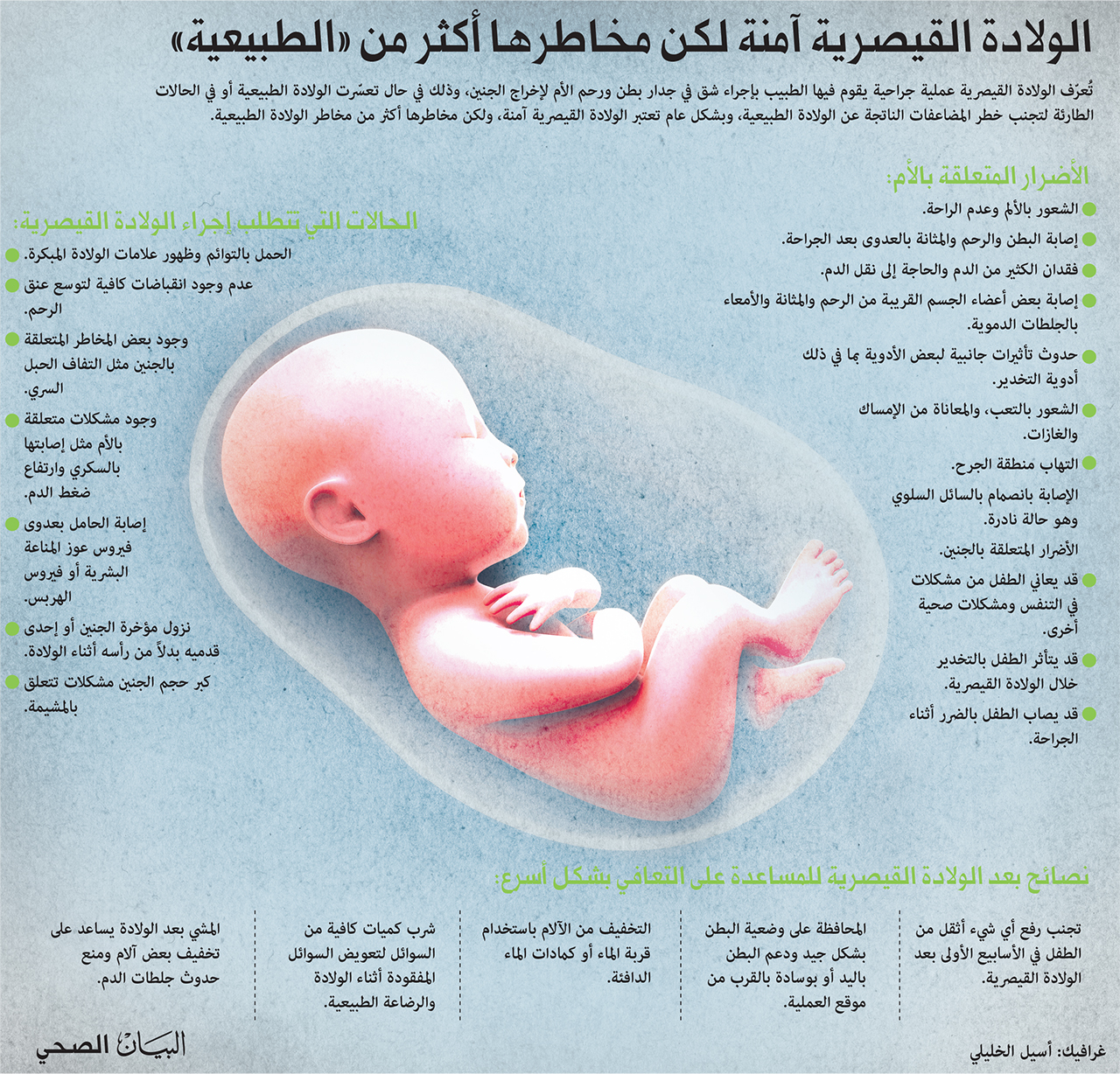 الولادة القيصرية آمنة لكن مخاطر أكثر من الولادة الطبيعية